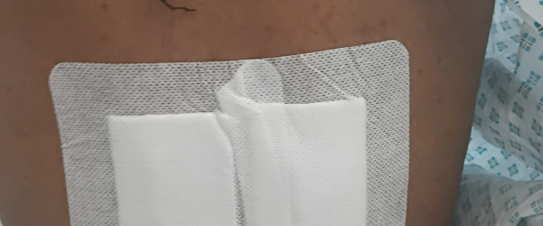 Fundraising for Rankine Mathew by British Malayali Charity Foundation fundraising photo 3