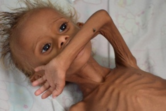 Yemen Crisis Appeal by Quba Trust cover photo